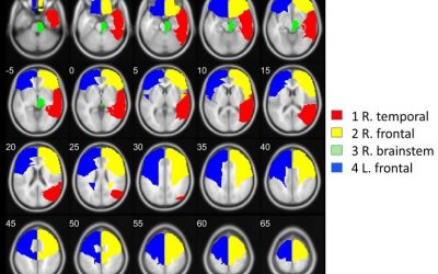 Meditación y Neurociencia. El Silencio Mental protege tu cerebro, según estudio de la ULL